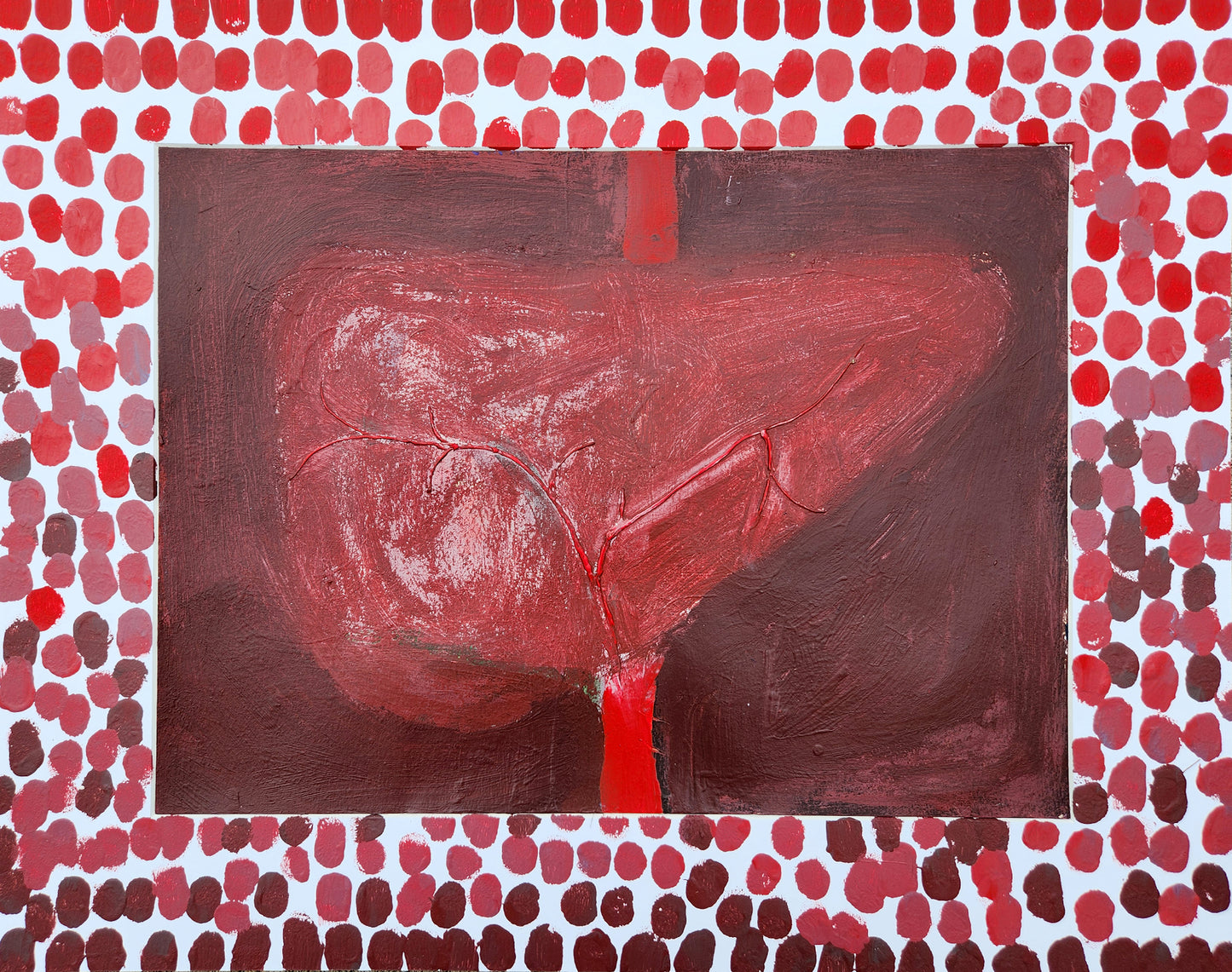Hepatic Artery #1