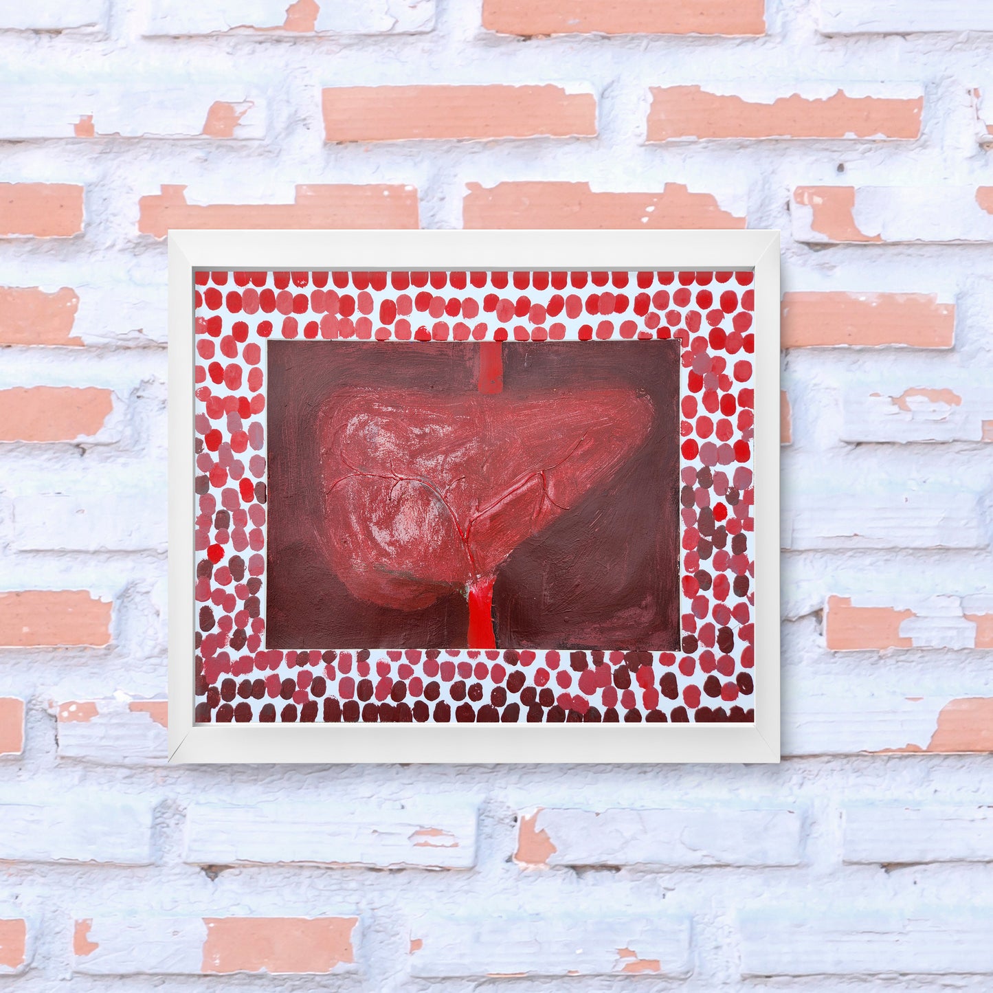 Hepatic Artery #1