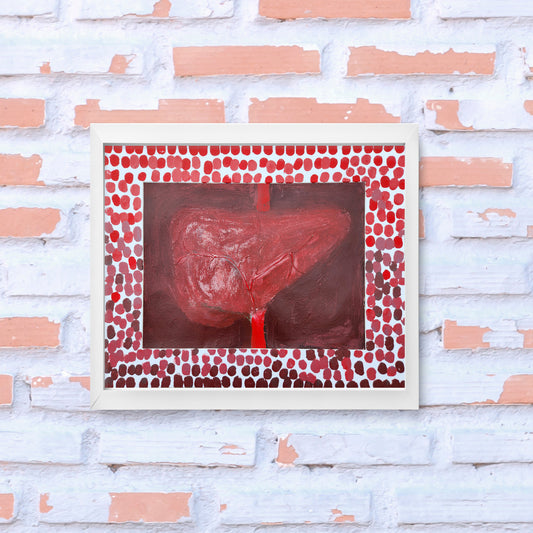 Hepatic Artery #1