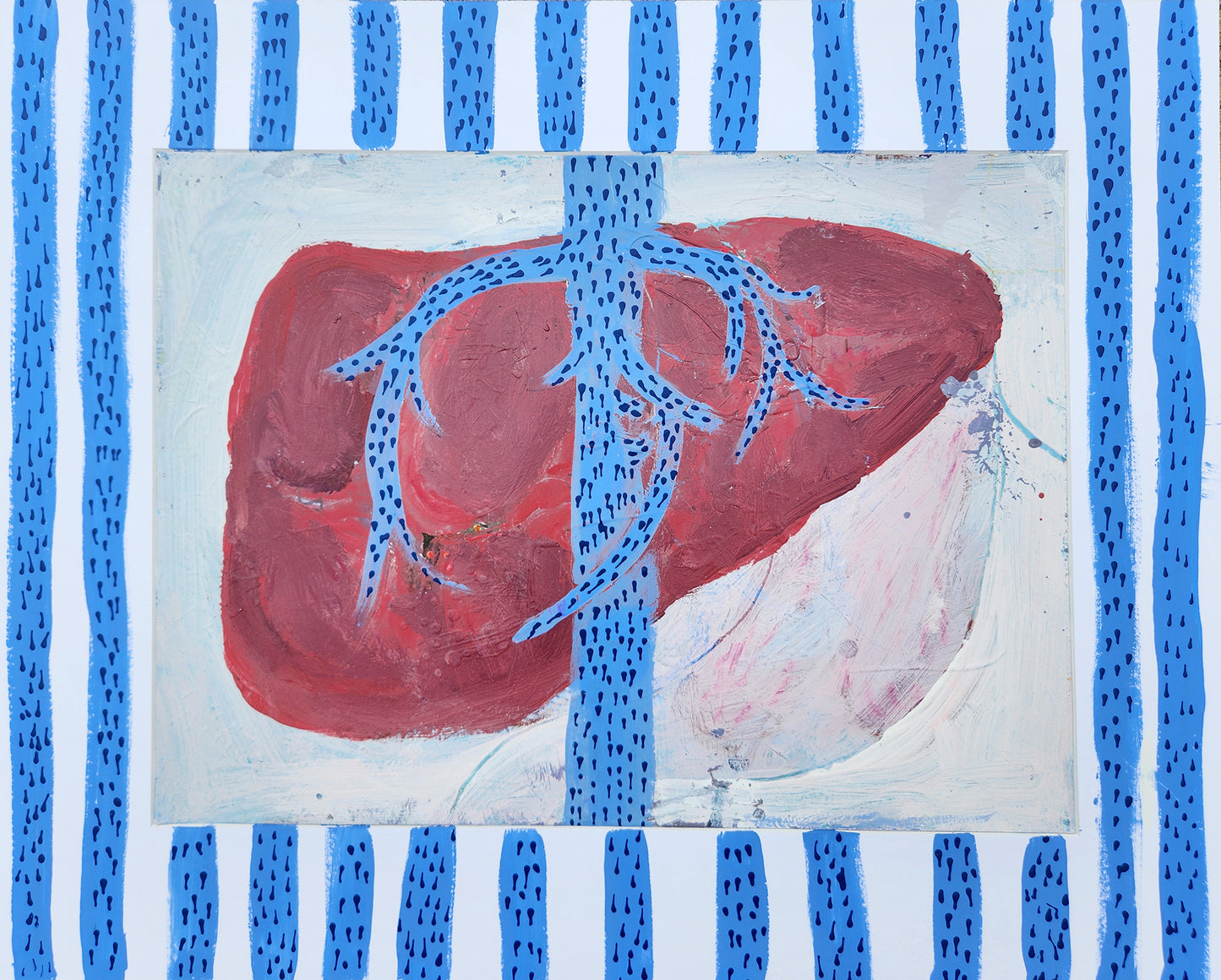 Hepatic Vein #1