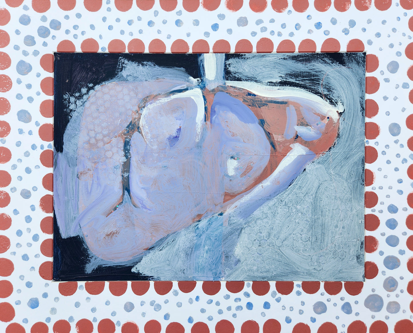 Hepatic Vein #2