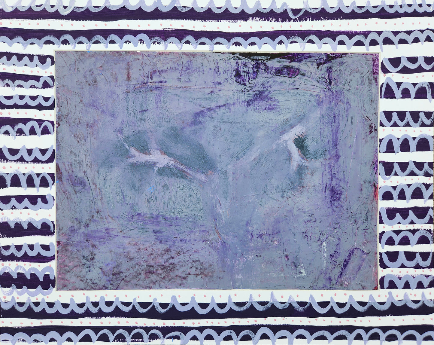 Portal Vein #1